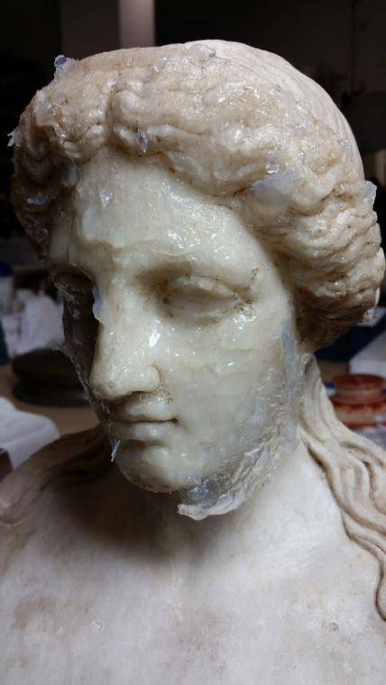 The bust during treatment, removing the agar/chelator poultice